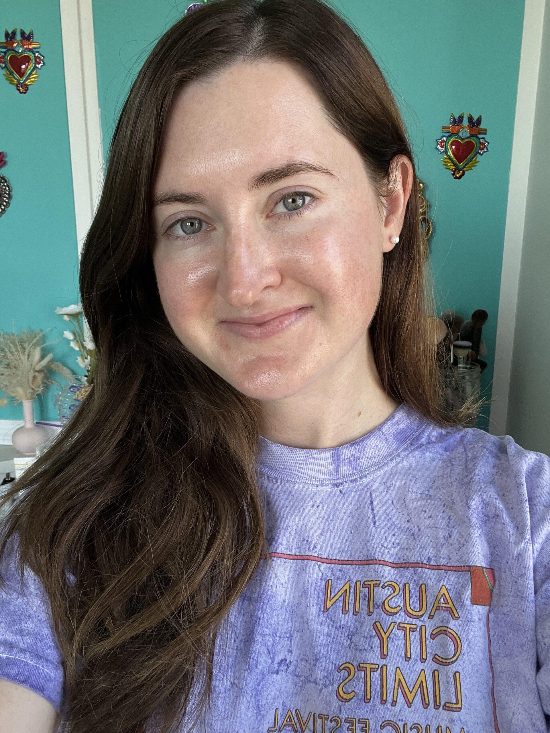 My skin with just moisturizer on