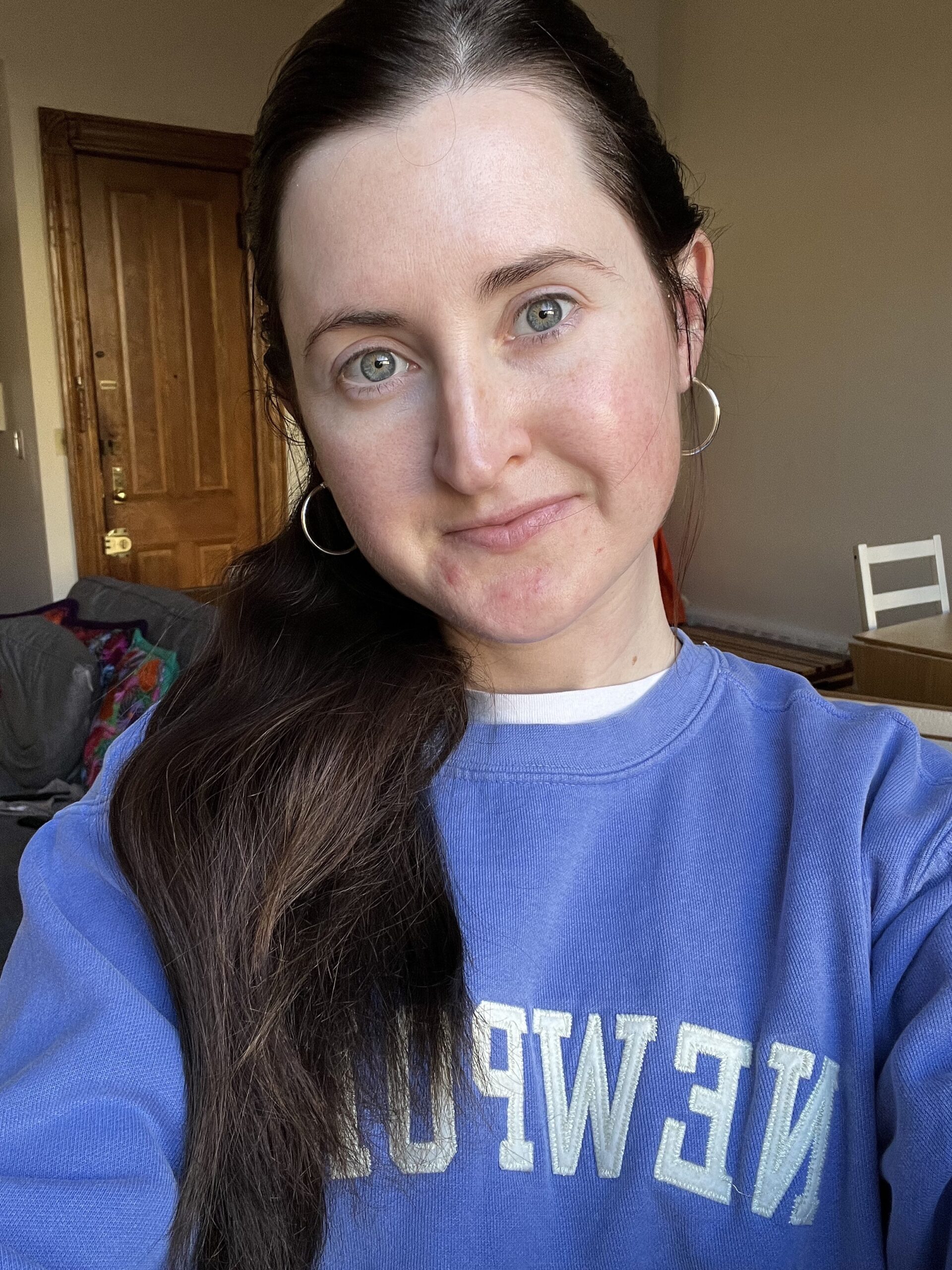 My skin with no makeup on My skin with no makeup on