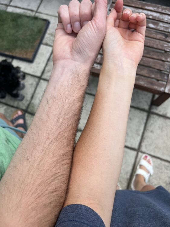 after Saltyface application After 7 hours of Saltyface application