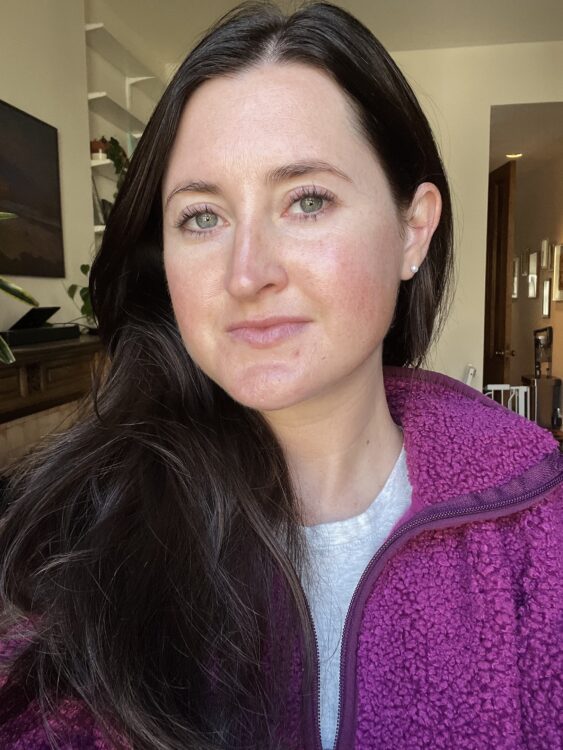 Before applying Subtl Beauty Staks Before applying Subtl Beauty Staks